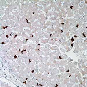 Hepatitis B Virus Surface Antigen (S1-210)