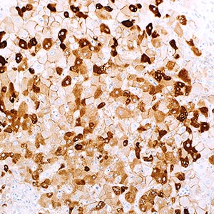 Hepatitis B Virus Surface Antigen (A10F1)