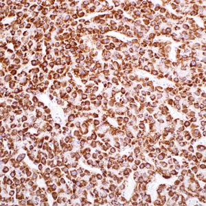 Hepatocyte Specific Antigen (Hep-Par1) (EP265)